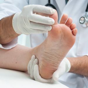 Athlete's Foot Treatment Near Me in Canton and Acton MA