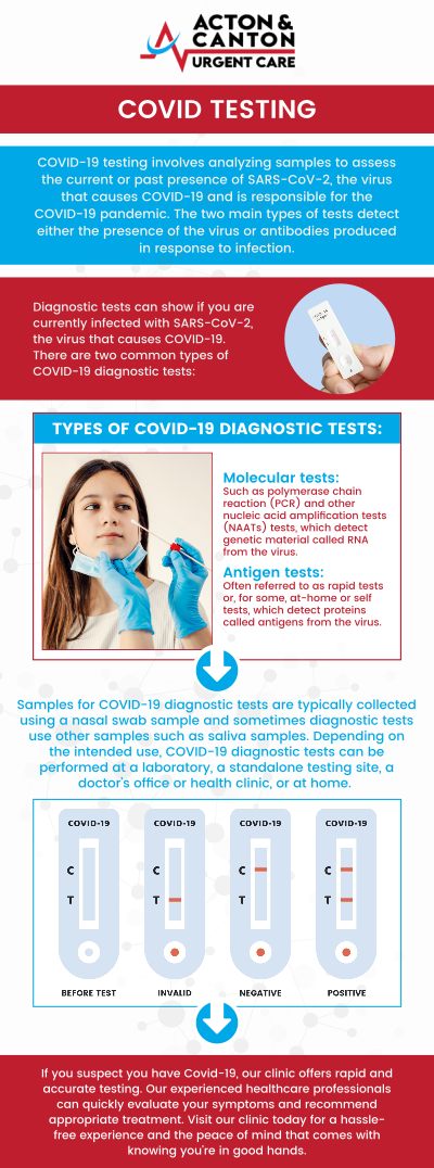 Common questions asked by patients: What are the most common symptoms of COVID-19? How does COVID-19 spread from person to person? When should I get tested for COVID-19? What should I do if I test positive for COVID-19? For more information, contact us or schedule an appointment online. We are located at 100 Powder Mill Rd, Acton, MA 01720. We serve patients from Acton MA, Maynard MA, Stow MA, Concord MA, Sudbury MA, Boxborough MA, and surrounding areas.
