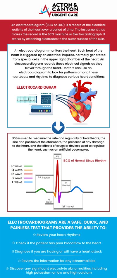 Common questions asked by patients: What is an EKG test and why is it done at urgent care? When should I visit urgent care for an EKG instead of the emergency room? How does an EKG help diagnose heart-related conditions? What symptoms indicate I might need an EKG test? For more information, contact us or schedule an appointment online. We are located at 100 Powder Mill Rd, Acton, MA 01720. We serve patients from Acton MA, Maynard MA, Stow MA, Concord MA, Sudbury MA, Boxborough MA, and surrounding areas. Common questions asked by patients: What is an EKG test and why is it done at urgent care? When should I visit urgent care for an EKG instead of the emergency room? How does an EKG help diagnose heart-related conditions? What symptoms indicate I might need an EKG test? For more information, contact us or schedule an appointment online. We are located at 100 Powder Mill Rd, Acton, MA 01720. We serve patients from Acton MA, Maynard MA, Stow MA, Concord MA, Sudbury MA, Boxborough MA, and surrounding areas.