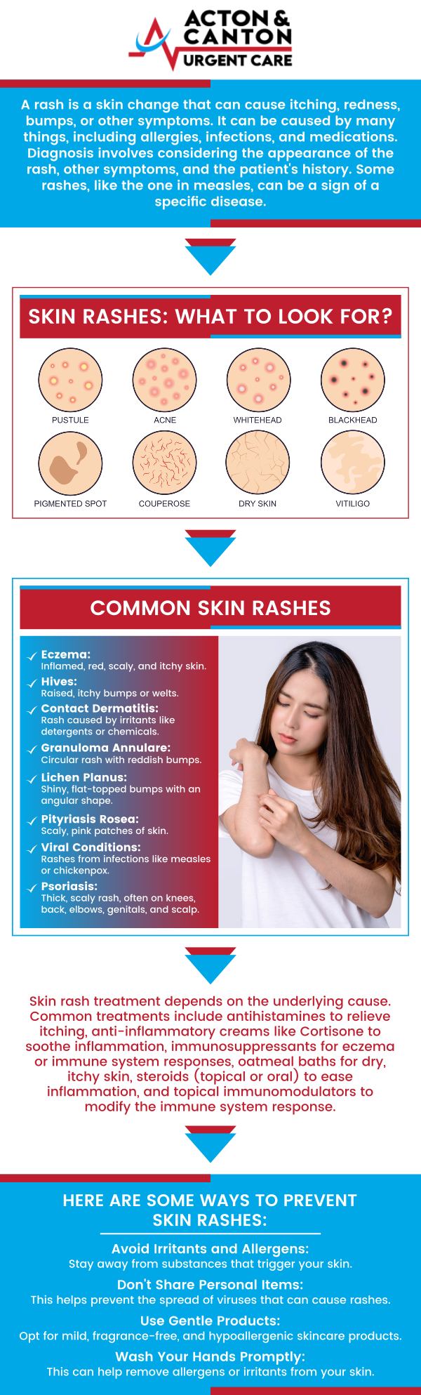 At Canton Urgent Care in Canton, MA, Muhammad Bajwa, MD, provides evaluation and treatment for various skin rashes caused by allergies, infections, or irritants. Common symptoms include redness, itching, swelling, or small bumps on the skin. Dr. Bajwa ensures accurate diagnosis and effective relief to restore skin comfort. For more information, contact us or schedule an appointment online. We are located at 95 Washington St, Ste 204 A, Canton, MA 02021. 