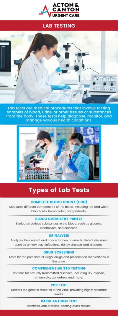 Lab testing is a crucial diagnostic tool that helps identify underlying health conditions and monitor overall well-being. Our clinic offers a wide range of accurate and reliable tests to help detect infections, manage chronic conditions, and guide treatment plans. Visit our experienced team at Acton Urgent Care today for professional lab testing with fast, confidential results. For more information, contact us or schedule an appointment online. We are located at 100 Powder Mill Rd, Acton, MA 01720. Lab testing is a crucial diagnostic tool that helps identify underlying health conditions and monitor overall well-being. Our clinic offers a wide range of accurate and reliable tests to help detect infections, manage chronic conditions, and guide treatment plans. Visit our experienced team at Acton Urgent Care today for professional lab testing with fast, confidential results. For more information, contact us or schedule an appointment online. We are located at 100 Powder Mill Rd, Acton, MA 01720.