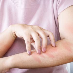 Skin Infection Treatment Near Me in Canton and Acton, MA