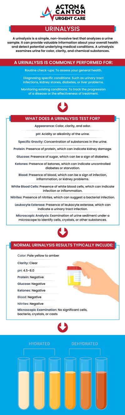 Common questions asked by patients: What is a urinalysis, and why is it performed? What can a urinalysis detect in terms of health issues? How should I prepare for a urinalysis test? What are the different types of urinalysis tests? For more information, contact us or schedule an appointment online. We are located at 100 Powder Mill Rd, Acton, MA 01720. We serve patients from Acton MA, Maynard MA, Stow MA, Concord MA, Sudbury MA, Boxborough MA, and surrounding areas. Common questions asked by patients: What is a urinalysis, and why is it performed? What can a urinalysis detect in terms of health issues? How should I prepare for a urinalysis test? What are the different types of urinalysis tests? For more information, contact us or schedule an appointment online. We are located at 100 Powder Mill Rd, Acton, MA 01720. We serve patients from Acton MA, Maynard MA, Stow MA, Concord MA, Sudbury MA, Boxborough MA, and surrounding areas.