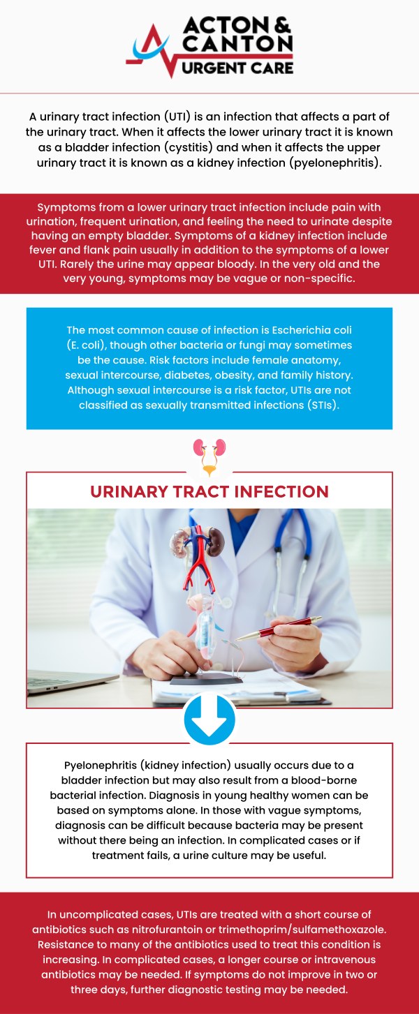 If you're experiencing symptoms of a urinary tract infection (UTI), Acton and Canton Urgent Care offers quick, reliable treatment to help alleviate discomfort and prevent further complications. Muhammad Bajwa, MD, and his experienced team provide thorough evaluations, accurate testing, and effective treatment options tailored to your needs. To manage your UTI and ensure a smooth recovery, contact us or schedule an appointment online. We are located at 95 Washington St, Ste 204 A, Canton, MA 02021.
