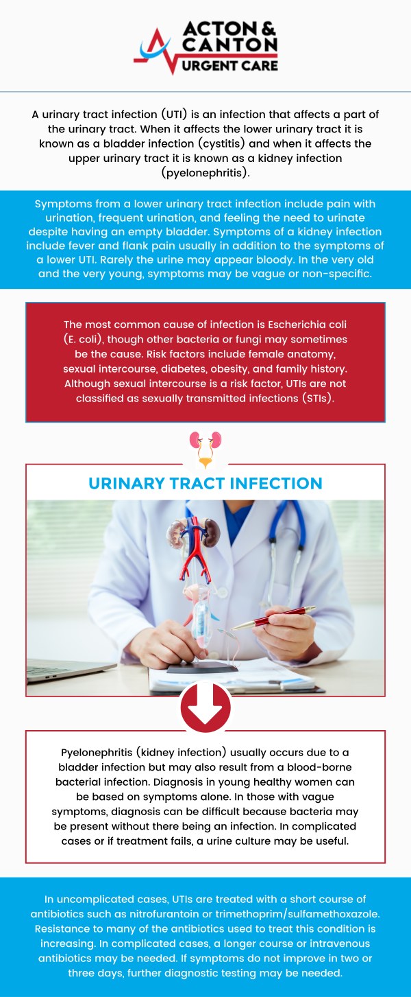 If you are experiencing the painful symptoms of a Urinary Tract Infection (UTI), Canton Urgent Care offers fast, confidential, and effective walk-in care right here in Canton, MA. Our clinic is equipped with an on-site lab to perform immediate urinalysis, providing a rapid diagnosis and allowing our providers to prescribe the necessary antibiotics or medications needed for quick relief. For more information, contact us or schedule an appointment online. We are located at 95 Washington St, Ste 204 A, Canton, MA 02021. If you are experiencing the painful symptoms of a Urinary Tract Infection (UTI), Canton Urgent Care offers fast, confidential, and effective walk-in care right here in Canton, MA. Our clinic is equipped with an on-site lab to perform immediate urinalysis, providing a rapid diagnosis and allowing our providers to prescribe the necessary antibiotics or medications needed for quick relief. For more information, contact us or schedule an appointment online. We are located at 95 Washington St, Ste 204 A, Canton, MA 02021.