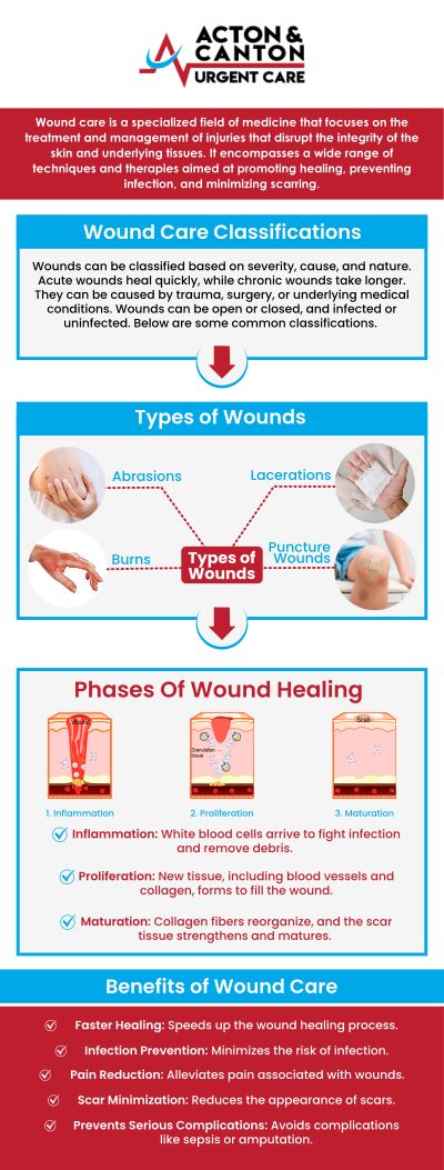 Acton and Canton Urgent Care provides comprehensive treatment for all types of wounds, ensuring quick and effective care for cuts, abrasions, and puncture wounds. Our experienced team utilizes advanced techniques to clean, close, and dress wounds, minimizing the risk of infection and promoting faster healing. For more information, contact us or schedule an appointment online. We are located at 95 Washington St, Ste 204 A, Canton, MA 02021. Acton and Canton Urgent Care provides comprehensive treatment for all types of wounds, ensuring quick and effective care for cuts, abrasions, and puncture wounds. Our experienced team utilizes advanced techniques to clean, close, and dress wounds, minimizing the risk of infection and promoting faster healing. For more information, contact us or schedule an appointment online. We are located at 95 Washington St, Ste 204 A, Canton, MA 02021.
