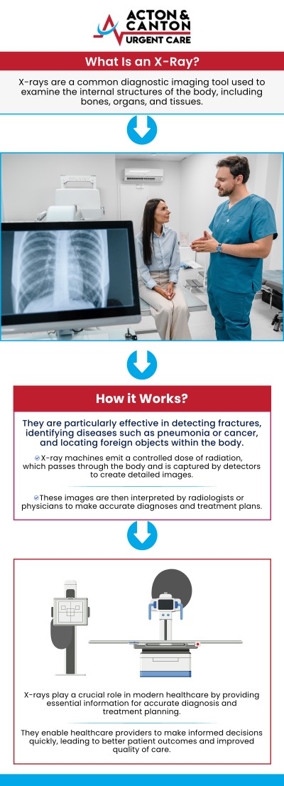 At Acton and Canton Urgent Care, we provide comprehensive urgent care services, including on-site X-ray capabilities for accurate diagnosis and immediate treatment. Whether you're suffering from a sprain, strain, or suspected fracture, visit Muhammad Bajwa, MD, for fast and accurate care. For more information, contact us or schedule an appointment online. We are located at 95 Washington St, Ste 204 A, Canton, MA 02021.