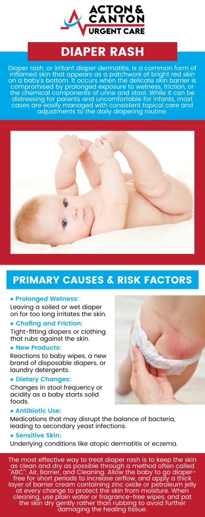 Common questions asked by patients: What causes diaper rash in babies and toddlers? How can I tell if my baby’s diaper rash is serious? What are the best ways to treat diaper rash at home? When should I see a doctor for a persistent diaper rash? For more information, contact us or schedule an appointment online. We are located at 95 Washington St, Ste 204 A, Canton, MA 02021. We serve patients from Canton MA, Sharon MA, Stoughton MA, Norwood MA, Walpole MA, Westwood MA, Milton MA, Raynham MA, and surrounding areas. Common questions asked by patients: What causes diaper rash in babies and toddlers? How can I tell if my baby’s diaper rash is serious? What are the best ways to treat diaper rash at home? When should I see a doctor for a persistent diaper rash? For more information, contact us or schedule an appointment online. We are located at 95 Washington St, Ste 204 A, Canton, MA 02021. We serve patients from Canton MA, Sharon MA, Stoughton MA, Norwood MA, Walpole MA, Westwood MA, Milton MA, Raynham MA, and surrounding areas.