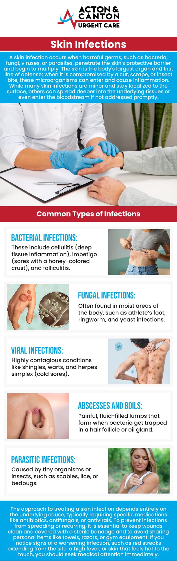 Common questions asked by patients: What are the most common types of skin infections? What causes skin infections to develop? How can I tell if a skin infection is bacterial, fungal, or viral? What are the typical symptoms of a skin infection? For more information, contact us or schedule an appointment online. We are located at 100 Powder Mill Rd, Acton, MA 01720. We serve patients from Acton MA, Maynard MA, Stow MA, Concord MA, Sudbury MA, Boxborough MA, and surrounding areas. Common questions asked by patients: What are the most common types of skin infections? What causes skin infections to develop? How can I tell if a skin infection is bacterial, fungal, or viral? What are the typical symptoms of a skin infection? For more information, contact us or schedule an appointment online. We are located at 100 Powder Mill Rd, Acton, MA 01720. We serve patients from Acton MA, Maynard MA, Stow MA, Concord MA, Sudbury MA, Boxborough MA, and surrounding areas.