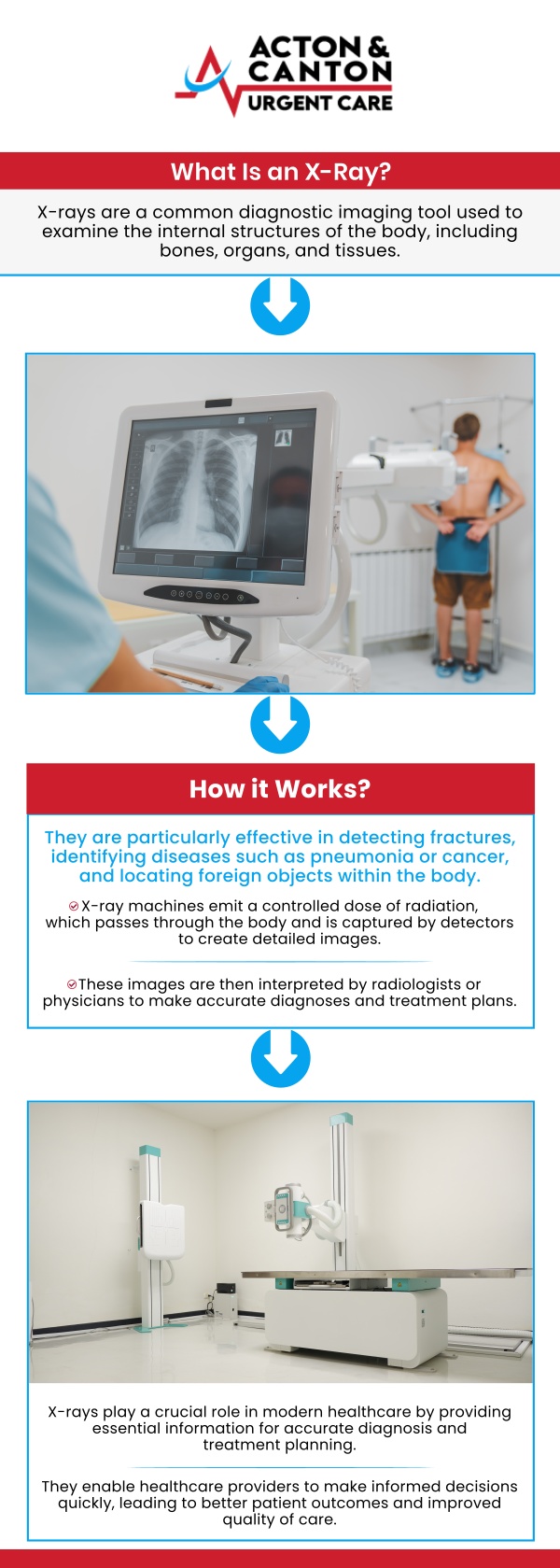 At its core, an X-ray is a quick, painless imaging test that uses a small amount of radiation to create pictures of the structures inside your body—particularly your bones. For patients at Acton Urgent Care, this technology is often the first line of defense in medical problem-solving. Our team of skilled professionals uses X-rays to see through soft tissue, capturing the dense structures beneath. For more information, contact us or schedule an appointment online. We are located at 100 Powder Mill Rd, Acton, MA 01720. At its core, an X-ray is a quick, painless imaging test that uses a small amount of radiation to create pictures of the structures inside your body—particularly your bones. For patients at Acton Urgent Care, this technology is often the first line of defense in medical problem-solving. Our team of skilled professionals uses X-rays to see through soft tissue, capturing the dense structures beneath. For more information, contact us or schedule an appointment online. We are located at 100 Powder Mill Rd, Acton, MA 01720.